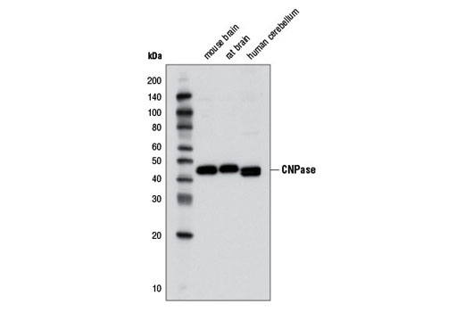 Western blot analysis of extracts from various brain tissues using CNPase (D83E10) XP ® Rabbit mAb.