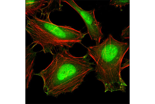 Confocal immunofluorescent analysis of HeLa cells using Cofilin (D3F9) XP ® Rabbit mAb (green). Actin filaments have been labeled with DY-554 phalloidin (red).
