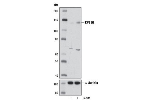 Western blot analysis of extracts from T98G cells, serum starved for 48 hr and then either untreated (-) or treated with 10% serum for 24 hr (+), using CP110 Antibody (upper) or α-Actinin (D6F6) XP ® Rabbit mAb #6487 (lower).