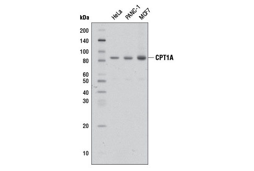 Western blot analysis of extracts from HeLa, PANC-1, and MCF7 cells using CPT1A (D3B3) Rabbit mAb.