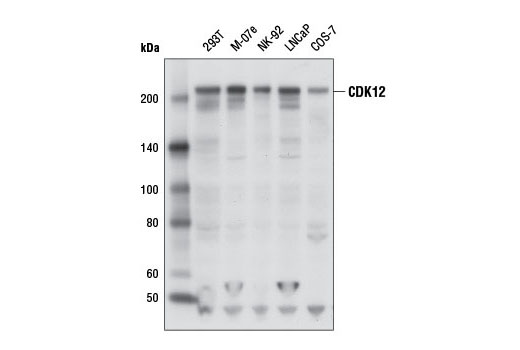 Western blot analysis of extracts from various cell lines using CDK12 Antibody.
