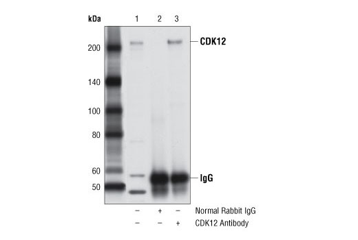Immunoprecipitation of CDK12 from PC-3 cell extracts using Normal Rabbit IgG #2729 (lane 2) or CDK12 Antibody (lane 3). Lane 1 is 10% input. Western blot analysis was performed using CDK12 Antibody.