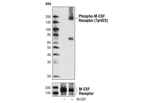 Western blot analysis of extracts from FDCP1/fms cells, untreated or M-CSF treated, using Phospho-M-CSF Receptor (Tyr923) Antibody (upper) or M-CSF Receptor Antibody #3152 (lower).