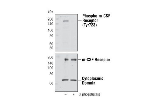 Western blot analysis of extracts from GDM-1 cells, untreated or λ phosphatase-treated, using Phospho-M-CSF Receptor (Tyr723) Antibody (upper) or M-CSF Receptor Antibody #3152 (lower).