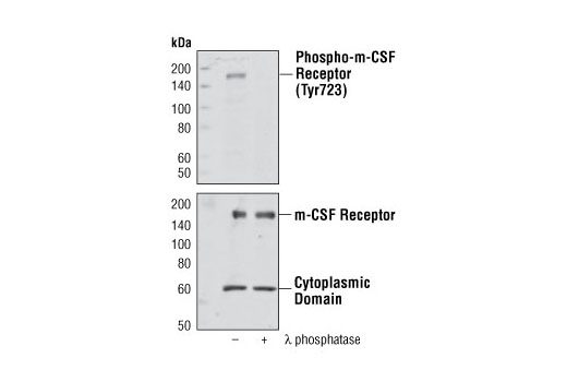 Western blot analysis of extracts from GDM-1 cells, untreated or λ phosphatase-treated, using Phospho-M-CSF Receptor (Tyr723) Antibody #3151 (upper) or M-CSF Receptor Antibody (lower).