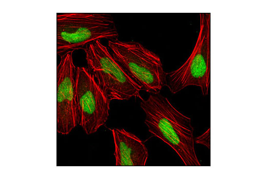 Confocal immunofluorescent analysis of HeLa cells using CTCF (D1A7) XP ® Rabbit mAb (green). Actin filaments are labeled with DY-554 phalloidin (red).