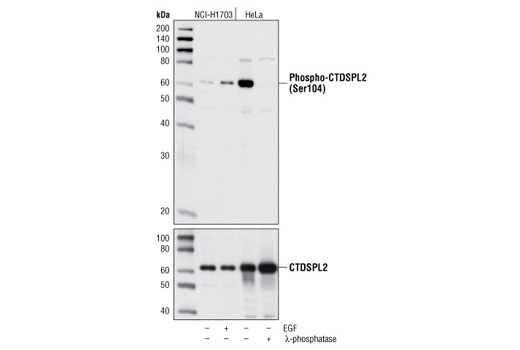 Western blot analysis of extracts from NCI-H1703 cells, untreated or EGF-treated, and HeLa cells, untreated or λ-phosphatase-treated, using Phospho-CTDSPL2 (Ser104) Antibody (upper) and a total CTDSPL2 antibody (lower).