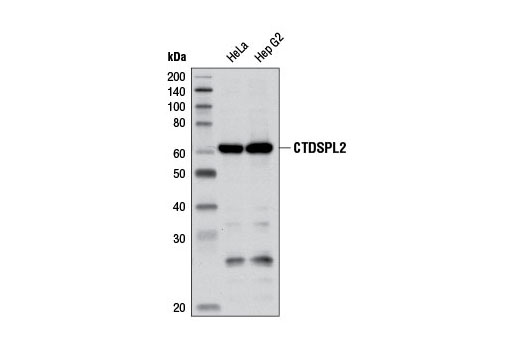 Western blot analysis of extracts from HeLa and Hep G2 cells using CTDSPL2 (D79G11) Rabbit mAb.