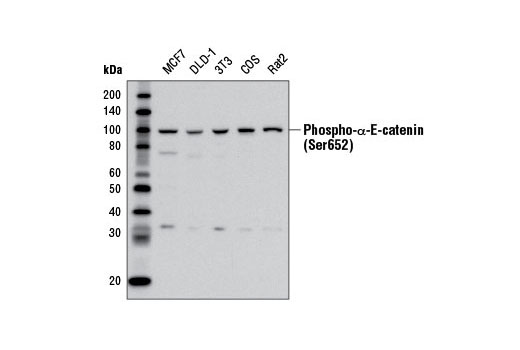 Western blot analysis of extracts from various cell lines using Phospho-α-E-Catenin (Ser652) Antibody.
