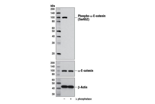 Western blot analysis of extracts from NCI-H3255 cells, untreated (-) or treated with λ phosphatase (+), using Phospho-α-E-Catenin (Ser652) Antibody (upper), α-E-Catenin (23B2) Rabbit mAb #3240 (middle) and β-Actin (D6A8) Rabbit mAb #8457 (lower).