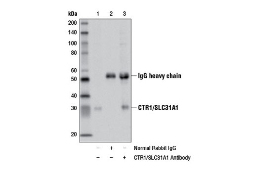 Immunoprecipitation of CTR1 from Hep G2 cell extracts using Normal Rabbit IgG #2729 (lane 2) or CTR1/SLC31A1 Antibody (lane 3). Lane 1 is 10% input. Western blot analysis was performed using CTR1/SLC31A1 Antibody.
