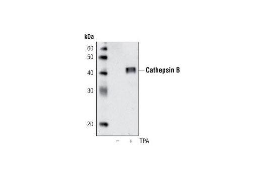 Western blot analysis of extracts from secreted protein from HL-60 cells, untreated or treated overnight with TPA #9905 (20 nM), using Cathepsin B (G60) Antibody.