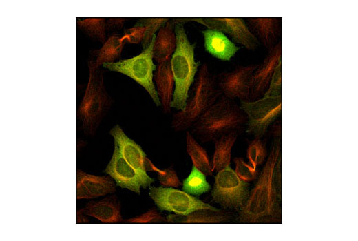 Confocal immunofluorescent analysis of HeLa cells using Cyclin B1 Antibody (green) and β-Tubulin (9F3) Rabbit mAb (Alexa Fluor® 555 Conjugate) #2116 (red) showing concentrated cyclin B1 staining surrounding mitotic chromatin.