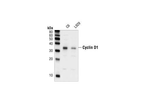 Western blot analysis of extracts from C6 and L929 cells, using Cyclin D1 Antibody.