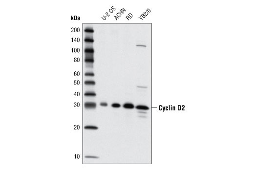 Western blot analysis of extracts from various cell lines using Cyclin D2 (D52F9) Rabbit mAb.