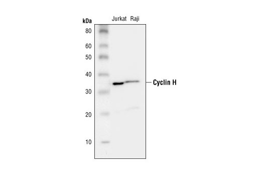Western blot analysis of extracts from Jurkat and Raji cells, using Cyclin H Antibody.