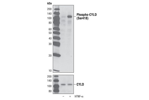 Western blot analysis of extracts from 293 cells, untreated or treated with hTNF-α #8902 (20 ng/ml for 20 minutes), using Phospho-CYLD (Ser418) Antibody (upper) or CYLD Antibody #4495 (lower).
