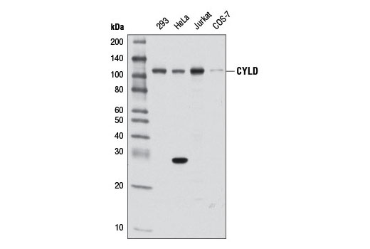 Western blot analysis of extracts from various cell lines using CYLD (D1A10) Rabbit mAb.