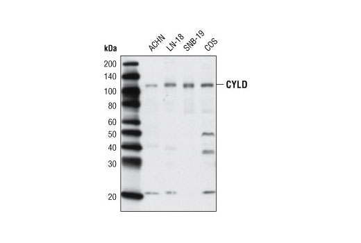 Western blot analysis of extracts from various cell lines using CYLD Antibody.