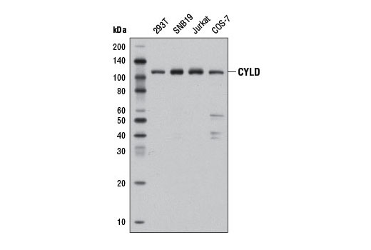 Western blot analysis of extracts from various cell lines using CYLD (D6O5O) Rabbit mAb.