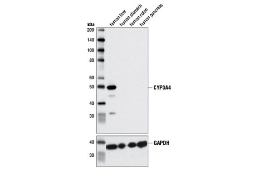 Western blot analysis of extract from various human tissues using CYP3A4 (D9U6N) Rabbit mAb (upper) and GAPDH (D16H11) XP® Rabbit mAb #5174 (lower). Antibody specifically detects CYP3A4 only in human liver, as expected.
