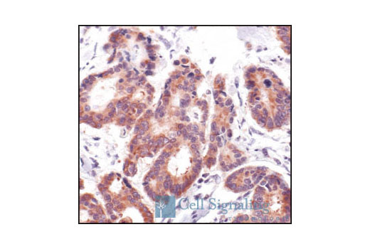 Immunohistochemical analysis of paraffin-embedded human colon carcinoma, using Cytochrome c Antibody.
