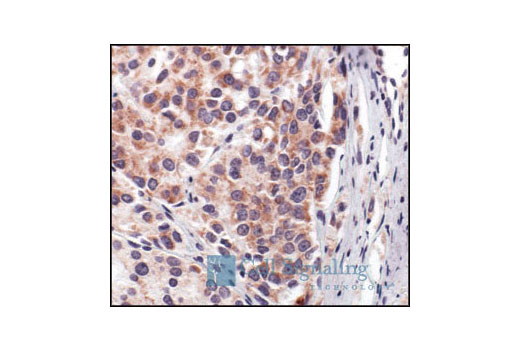 Immunohistochemical analysis of paraffin-embedded human prostate carcinoma, using Cytochrome c Antibody.