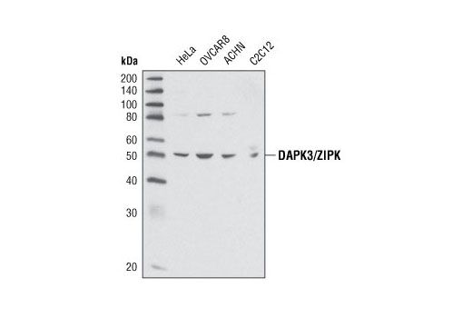 Western blot analysis of extracts from various cell lines using DAPK3/ZIPK Antibody.