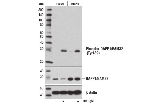Western blot analysis of extracts from Daudi and Ramos cells, untreated (-) or treated with anti-IgM (12 μg/ml, 10 min; +), using Phospho-DAPP1/BAM32 (Tyr139) (D7G4G) Rabbit mAb (upper), DAPP1/BAM32 (D9K4O) Rabbit mAb #13598 (middle), and β-Actin (D6A8) Rabbit mAb #8457 (lower).