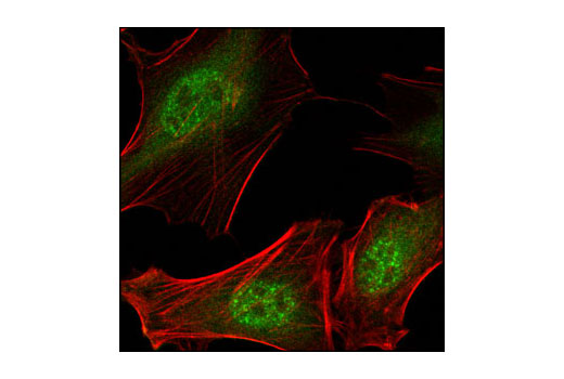 Confocal immunofluorescent analysis of HeLa cells using Daxx (25C12) Rabbit mAb (green). Actin filaments have been labeled with Alexa Fluor® 555 phalloidin (red).