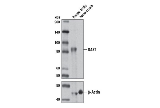 Western blot analysis of extracts from human testis and brain tissue using DAZ1 Antibody (upper) or β-Actin (D6A8) Rabbit mAb #8457 (lower).