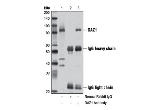 Immunoprecipitation of DAZ1 from human testis extracts using Normal Rabbit IgG #2729 (lane 2) or DAZ1 Antibody (lane 3). Lane 1 is 10% input. Western blot analysis was performed using DAZ1 Antibody.