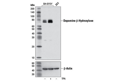 Western blot analysis of extracts from SH-SY5Y cells, untreated (-) or treated with TPA (200 nM, 24 hr) #4174 (+), and 293 cells, using Dopamine β-Hydroxylase (DBH) Antibody.