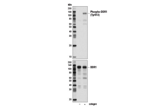 Western blot analysis of extracts from T47-D cells, untreated (-) or treated with collagen (20 μg/ml, 18 hr; +), using Phospho-DDR1 (Tyr513) (E1N8F) Rabbit mAb (upper) and DDR1 (D1G6) XP ® Rabbit mAb #5583 (lower).