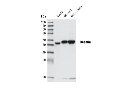 Western blot analysis of extracts from C2C12 cells, rat heart and human heart using Desmin (D93F5) XP ® Rabbit mAb.