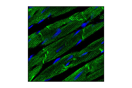 Confocal immunofluorescent analysis of rat heart using Desmin Antibody (green). Blue pseudocolor = DRAQ5 ® #4084 (fluorescent DNA dye).