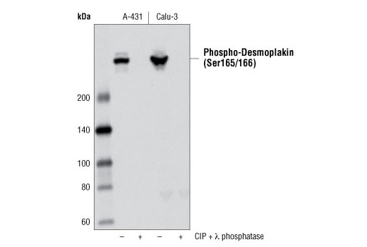 Western blot analysis of extracts from A-431 and Calu-3 cells, untreated or treated with calf intestinal phosphatase (CIP) and λ phosphatase, using Phospho-Desmoplakin (Ser165/166) Antibody.