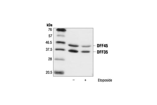 Western blot analysis of Jurkat cells, untreated (control) or etoposide-treated (25 µM), using DFF45/DFF35 Antibody.