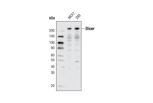 Western blot analysis of extracts from MCF7 and 293 cells using Dicer (D5F2) Rabbit mAb.