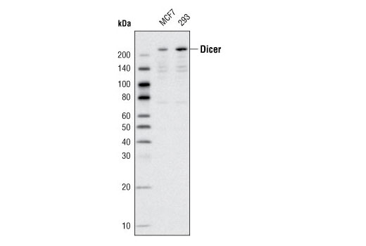 Western blot analysis of extracts from MCF7 and 293 cells using Dicer (D38E7) Rabbit mAb.