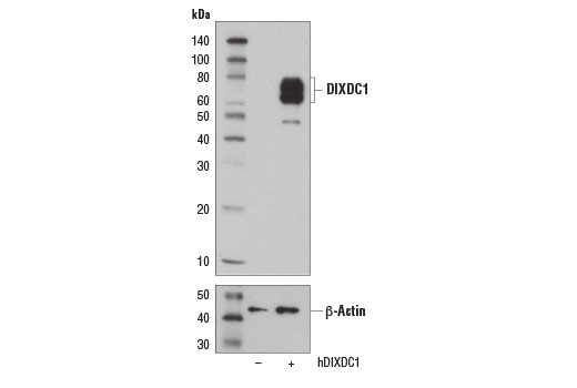 Western blot analysis of extracts from 293T cells mock transfected (-) or transfected with human DIXDC1 (hDIXDC1, +), using DIXDC1 (D7P6Q) Rabbit mAb (upper) and β-Actin (D6A8) Rabbit mAb #8457 (lower).