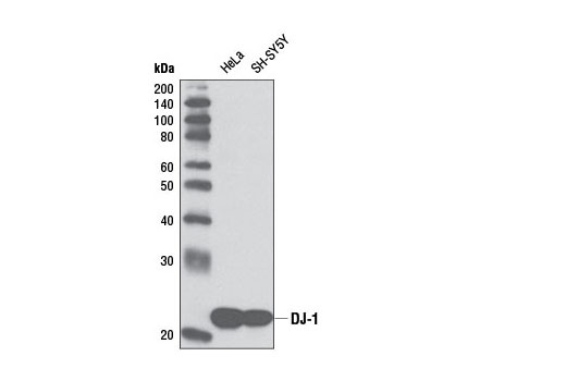 Western blot analysis of extracts from various cell lines and tissue using DJ-1 (D21E11) Rabbit mAb.