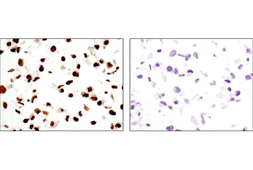 Immunohistochemical analysis of paraffin-embedded cell pellets, M059K (DNA-PKcs wild-type; left) or M059J (DNA-PKcs deficient; right), using DNA-PKcs (3H6) Mouse mAb.