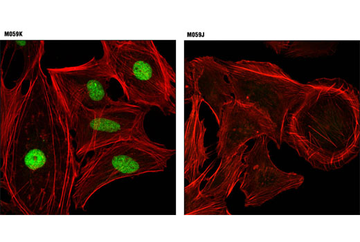 Confocal immunofluorescent analysis of M059K (DNA-PKcs wild-type; left) and M059J (DNA-PKcs deficient; right) cells using DNA-PKcs (3H6) Mouse mAb (green). Actin filaments were labeled with DY-554 phalloidin (red).