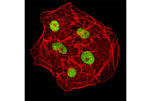 Confocal immunofluorescent analysis of COS cells using DNMT1 (D63A6) XP ® Rabbit mAb (green). Actin filaments were labeled using DY-554 phalloidin (red).