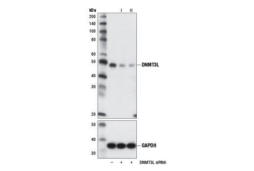 Western blot analysis of extracts from F9 cells, transfected with 100 nM SignalSilence ® Control siRNA (Unconjugated) #6568 (-), SignalSilence ® DNMT3L siRNA I (Mouse Specific) #12307 (+), or SignalSilence ® DNMT3L siRNA II (Mouse Specific) #12308 (+), using DNMT3L (E1Y7Q) Rabbit mAb (Mouse Specific) (upper) or GAPDH (D16H11) XP ® Rabbit mAb #5174 (lower). The DNMT3L (E1Y7Q) Rabbit mAb (Mouse Specific) confirms silencing of DNMT3L expression, while the GAPDH (D16H11) XP ® Rabbit mAb is used as a loading control.