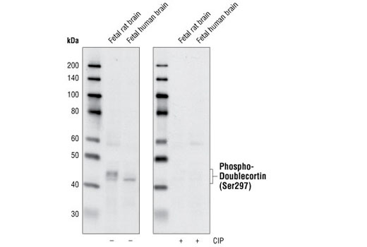 Western blot analysis of extracts from fetal rat and fetal human brain using Phospho-Doublecortin (Ser297) Antibody. The phospho-specificity of the antibody was verified by treating the membrane with (+) or without (-) calf intestinal phosphatase (CIP) after Western transfer.