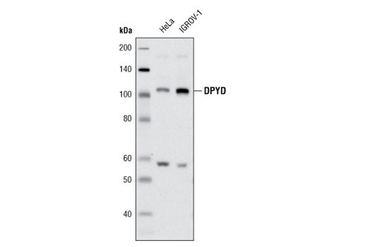 Western blot analysis of extracts from HeLa and IGROV-1 cells using DPYD (D35A8) Rabbit mAb.