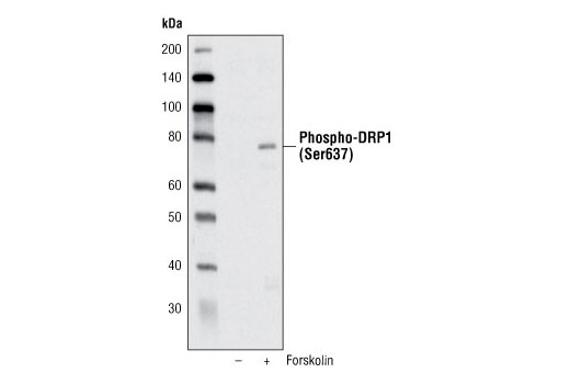 Western blot analysis of extracts from PC-12 cells, untreated or treated with 20uM Forskolin #3828 for 1 hour, using Phospho-DRP1 (Ser637) Antibody.