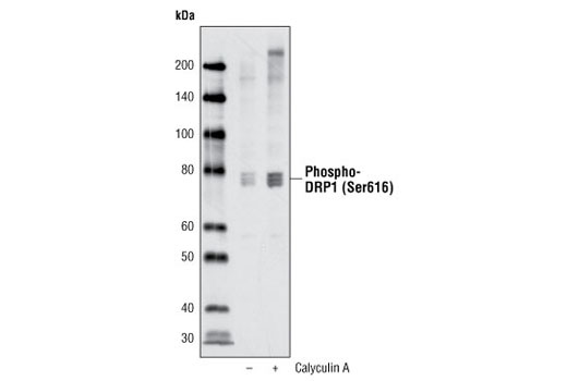 Western blot analysis of extracts from HeLa cells, untreated or treated with Calyculin A #9902, using Phospho-DRP1 (Ser616) Antibody.